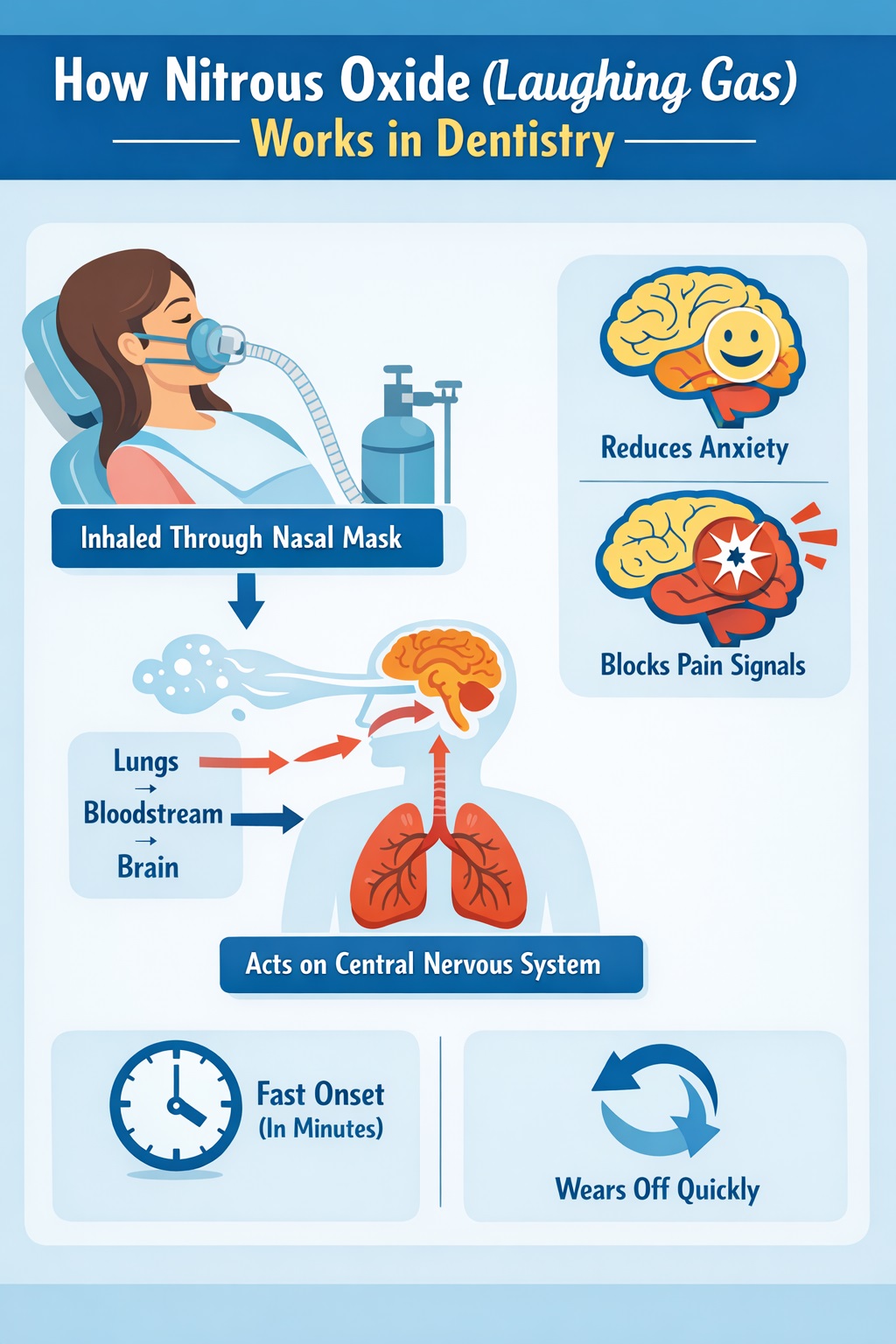 Diagram showing how nitrous oxide works in dental sedation by calming the brain and reducing pain perception.